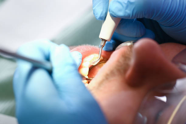 Best Mobile Emergency Dentist in Berrien Springs, MI