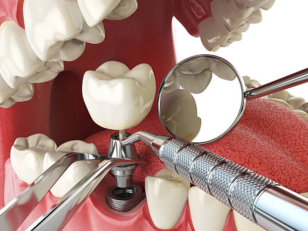 Best Mobile Emergency Dentist in Berrien Springs, MI